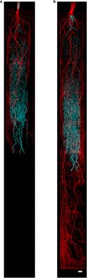 Spatio-Temporal Variation in Water Uptake in Seminal and Nodal Root Systems of Barley Plants Grown in Soil